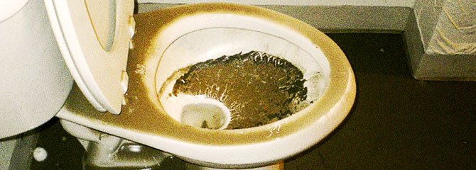 Image result for picture of a dirty toilet bowl